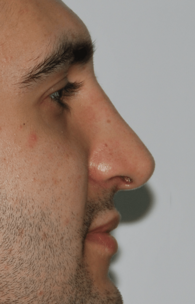 Schermata 2021-07-24 alle 18.40.16