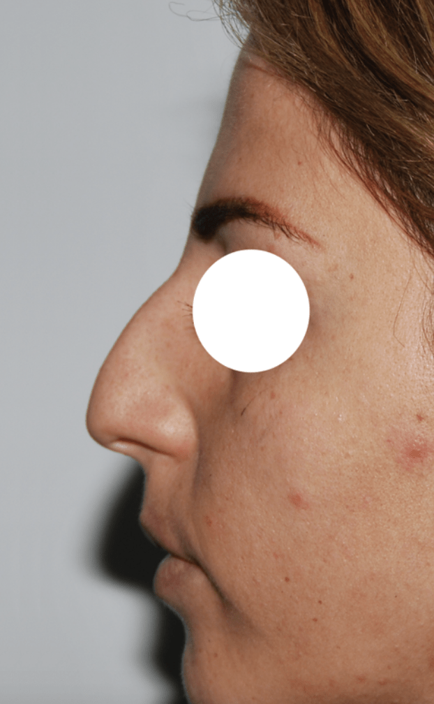 Schermata 2021-07-24 alle 18.45.10