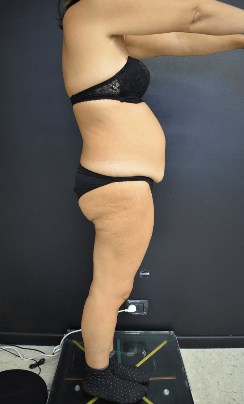 Addominoplastica Catania Majani dpre