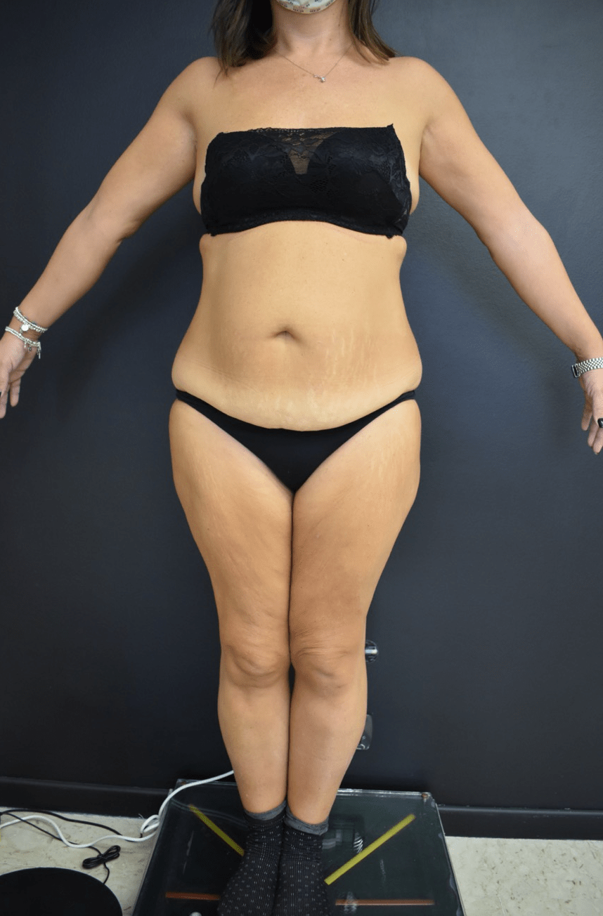 Addominoplastica Majani Catania apre