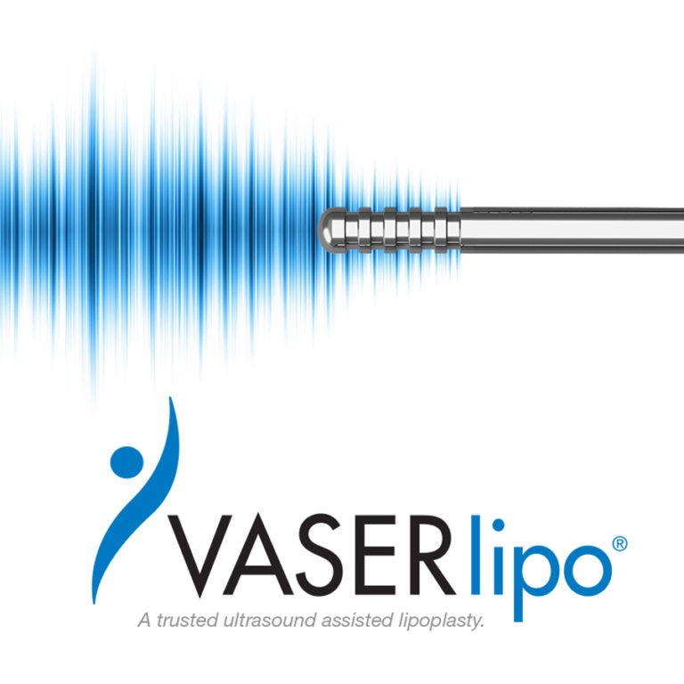 vaserlipo