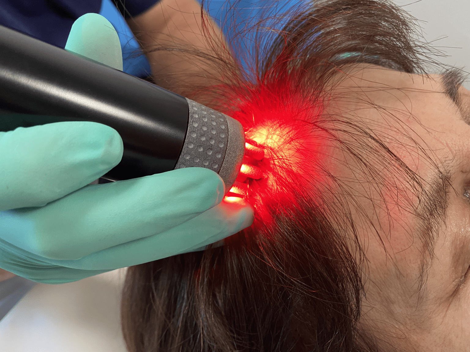 “Immagine del Dott. Majani, esperto nella cura e trattamento dell’Alopecia a Catania